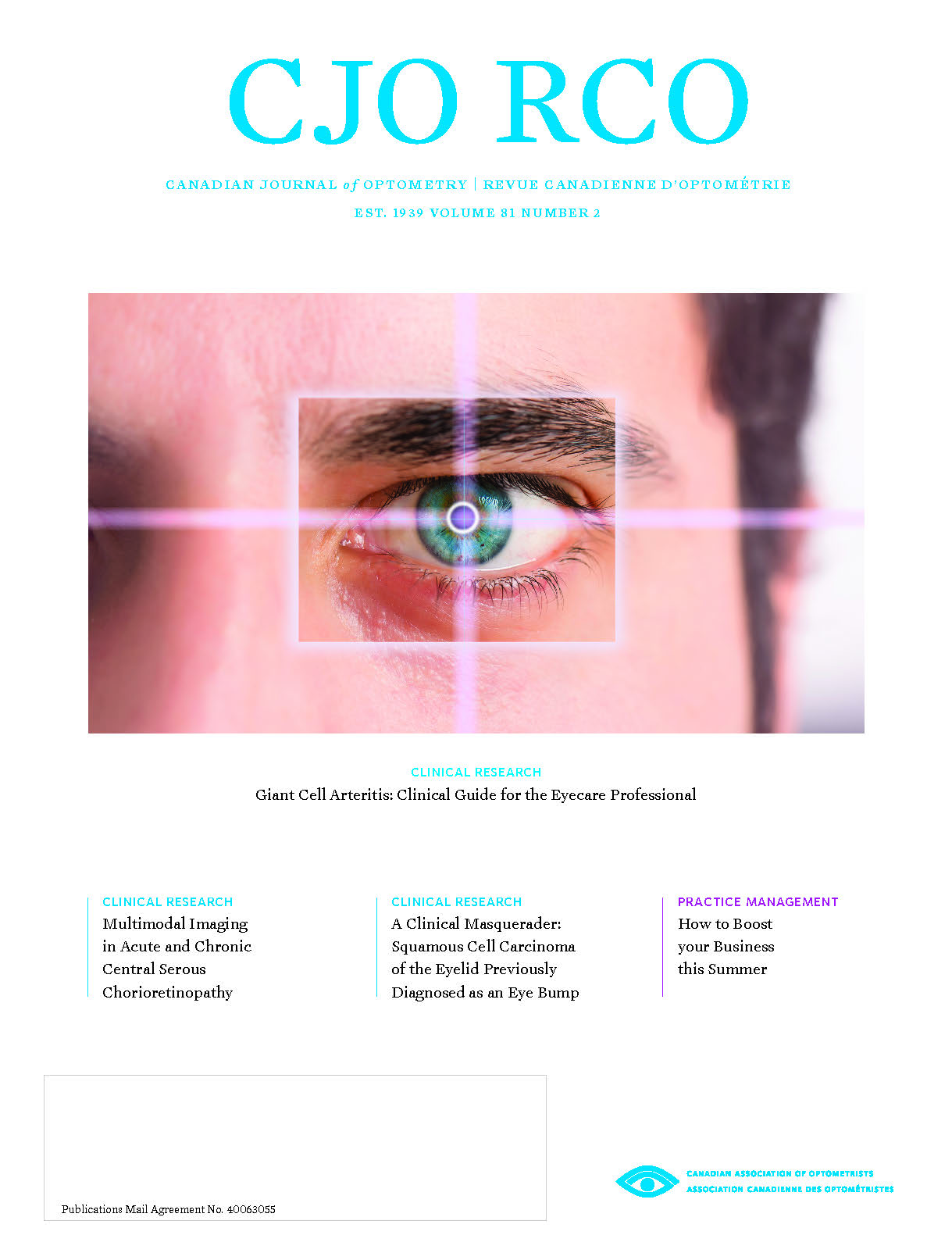 Does eye insurance cover lasik information